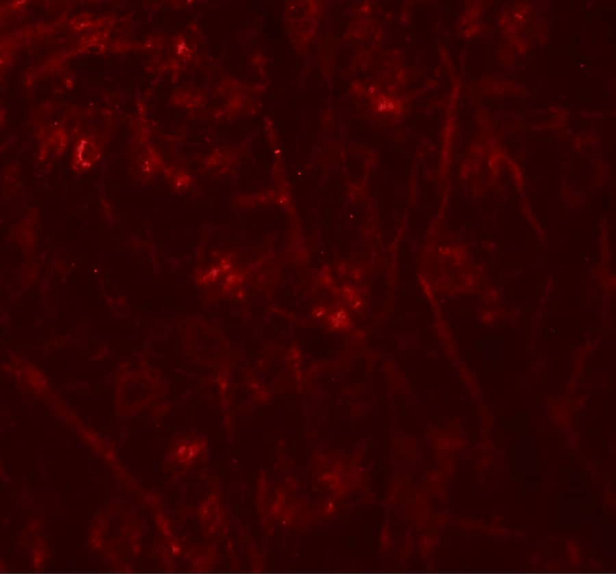 Immunocytochemistry/ Immunofluorescence: TMEM106A Antibody - BSA Free [NBP2-41165] - Immunofluorescence of TMEM106A in mouse brain tissue with TMEM106A antibody at 20 ug/mL.