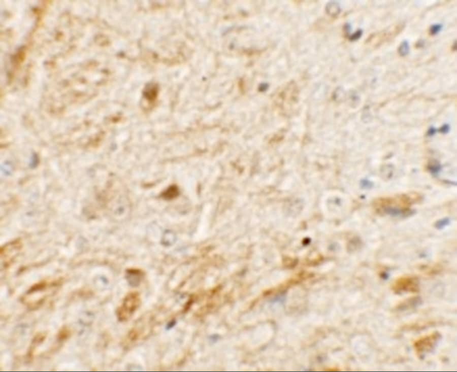 Immunohistochemistry: TMEM106A Antibody - BSA Free [NBP2-41165] - Immunohistochemistry of TMEM106A in mouse brain tissue with TMEM106A antibody at 5 ug/mL.