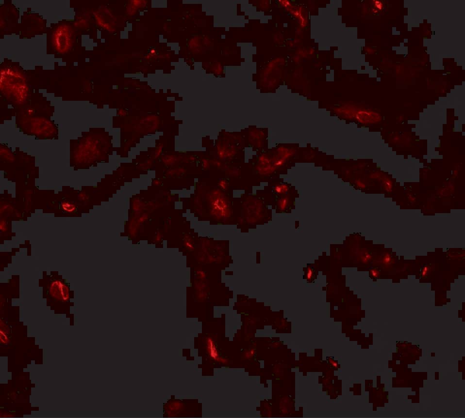 Immunocytochemistry/ Immunofluorescence: TFEB Antibody - BSA Free [NBP2-41167] - Immunofluorescence of TFEB in human lung tissue with TFEB antibody at 20 u/mL.