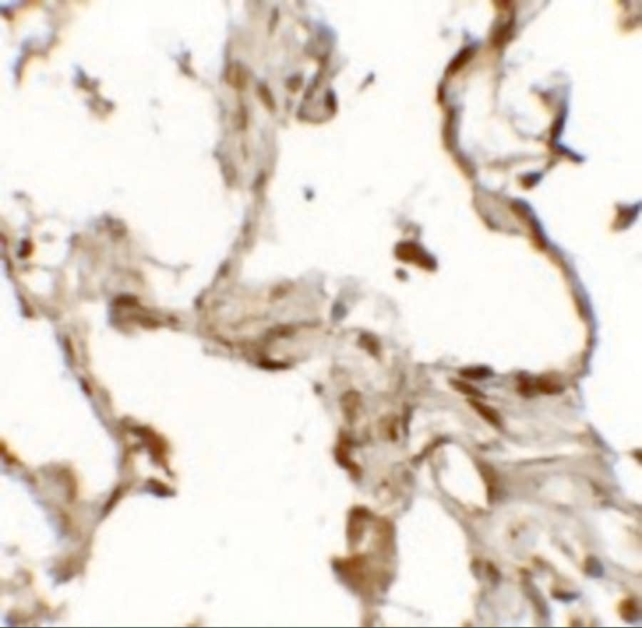 Immunohistochemistry: TFEB Antibody - BSA Free [NBP2-41167] - Immunohistochemistry of TFEB (NT) in human lung tissue with TFEB (NT) antibody at 2.5 u/mL.