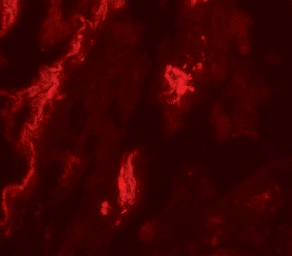 Immunocytochemistry/ Immunofluorescence: TFEB Antibody - BSA Free [NBP2-41168] - Immunofluorescence of TFEB in human lung tissue with TFEB antibody at 20 u/mL.