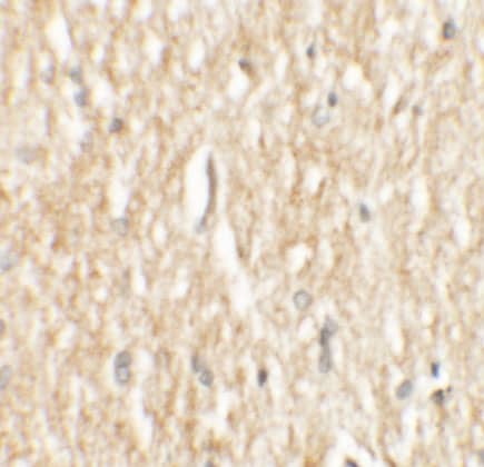 Immunohistochemistry PHOX2A Antibody - BSA Free