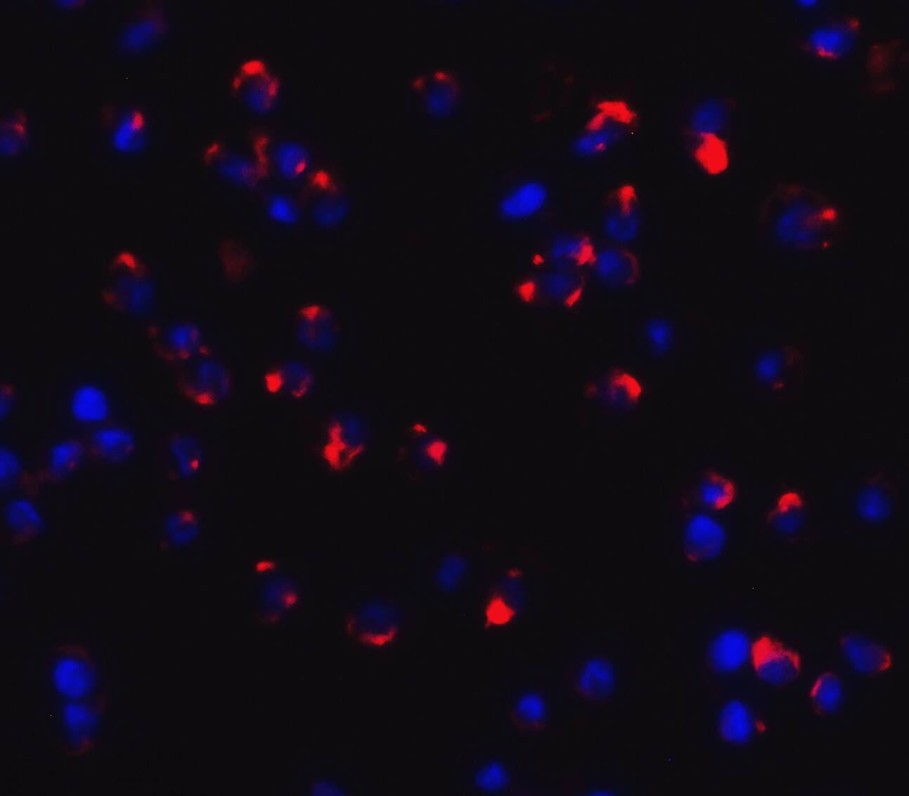 Immunocytochemistry/ Immunofluorescence: Dectin-1/CLEC7A Antibody - BSA Free [NBP2-41170] - Immunofluorescence of Dectin-1/CLEC7A in Jurkat cells with Dectin-1/CLEC7A antibody at 20 u/mL.