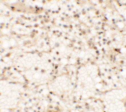 Immunohistochemistry: Dectin-1/CLEC7A Antibody - BSA Free [NBP2-41170] - Immunohistochemistry of Dectin-1/CLEC7A in human spleen tissue with Dectin-1/CLEC7A antibody at 5 u/mL.