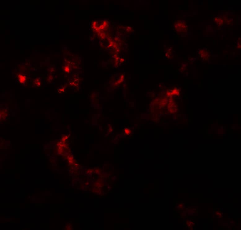 Immunocytochemistry/ Immunofluorescence TTYH2 Antibody - BSA Free