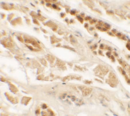 Immunohistochemistry TTYH2 Antibody - BSA Free