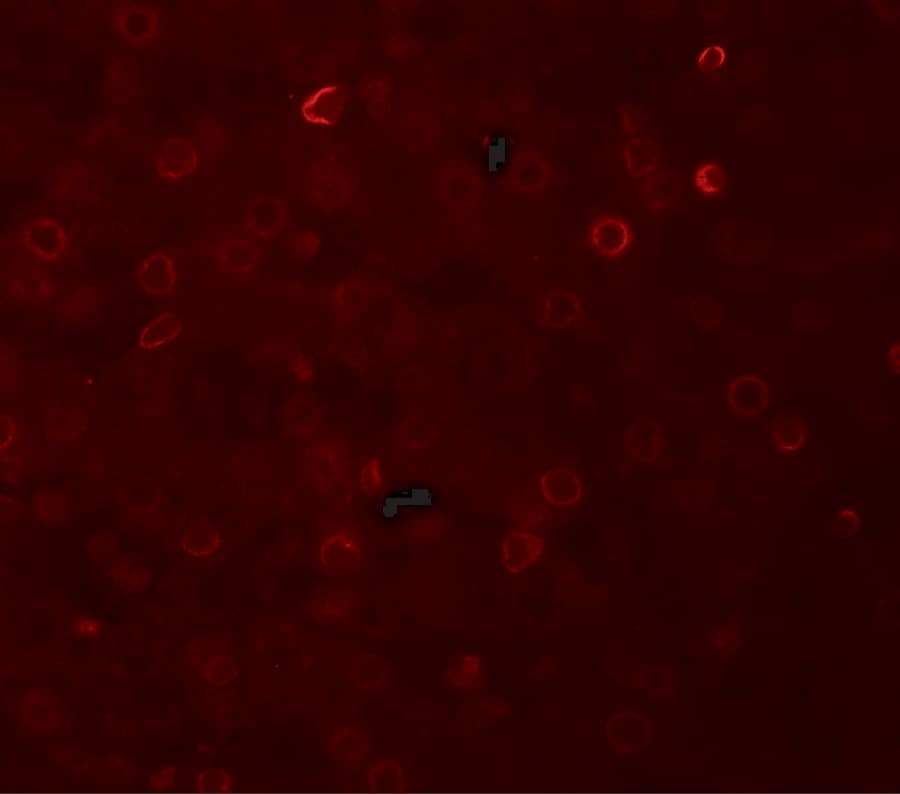 Immunocytochemistry/ Immunofluorescence TRACP/PAP/ACP5 Antibody - BSA Free