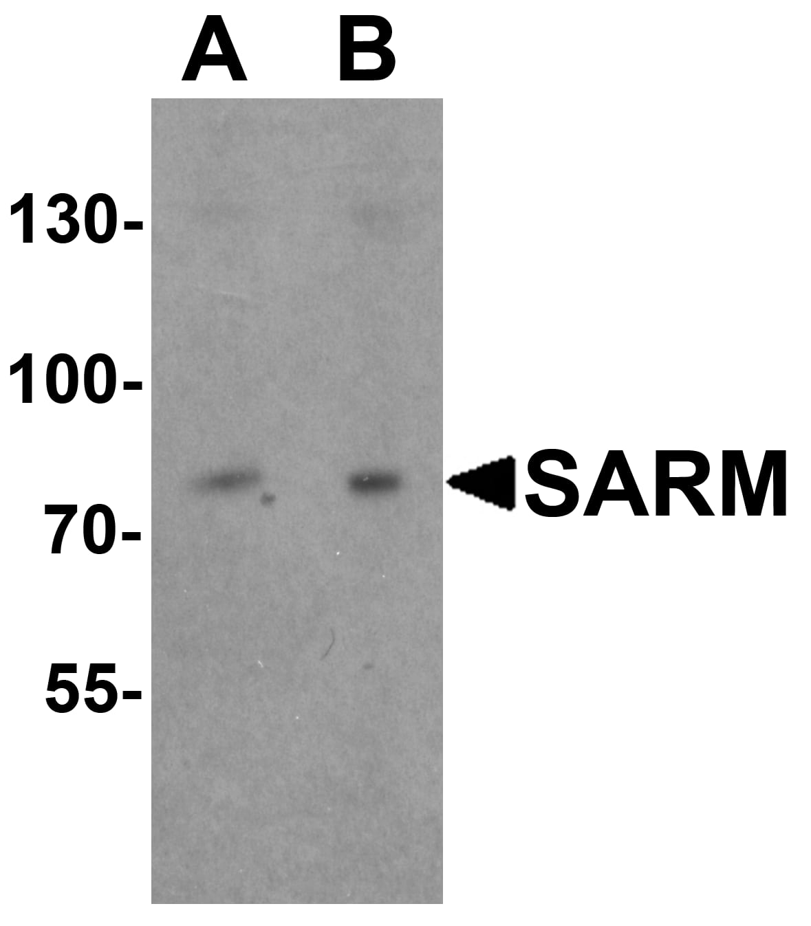 Western Blot: SARM1 Antibody - BSA Free [NBP2-41180] - Western blot analysis of SARM1 in Daudi cell lysate with SARM1 antibody at (A) 1 and (B) 2 ug/mL.