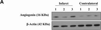 Western Blot: Angiogenin Antibody - BSA Free [NBP2-41185] - Angiogenin & EPCs modulation after mouse cerebral ischemia & rehabilitation. (A) Infarct & contralateral mouse brain cortical homogenates were analyzed by western blot to quantify angiogenin protein (n = 3). The densitometry results (arbitrary units) were corrected by the actin load & are represented as fold-change of the ipsilateral vs. contralateral signal. (B) Bar graphs representing the angiogenin RNA expression in the ischemic & contralateral cortex in the short-term (n = 6–9) & long-term rehabilitation groups (n = 5), **p < 0.01, *p < 0.05 as indicated by horizontal lines. Non-RHB ipsilateral short-term vs. long-term; &p < 0.05. Pasta Matrix & Treadmill contralateral short-term vs. long-term; †p < 0.05. (C) Bar graphs showing the percentage of the Angiogenin+ area in the pasta matrix long-term rehabilitation group (n = 6) together with images of representative brains with inserts showing co-localization of angiogenin in neurons: scale bar represents 100 μm. *p < 0.05. (D) Graph showing the plasma angiogenin temporal profile of No-RHB, Pasta matrix, & Treadmill groups (n = 3–4/group); *p < 0.05. (E) Box plots representing the cell density of EPCs from the three different RHB groups (n = 3–5 short-term; n = 6–7 long-term) & representative images of the primary cultures; scale bar represents 250 μm. Data are represented as the mean ± SEM or as box plots indicating the median (IQR). IP, ipsilateral; CL, contralateral; ST-R, short-term rehabilitation; LT-R, long-term rehabilitation; No-RHB, No-Rehabilitation; EPC, endothelial progenitor cells. Image collected & cropped by CiteAb from the following publication (//www.frontiersin.org/article/10.3389/fneur.2018.00508/full), licensed under a CC-BY license. Not internally tested by Novus Biologicals.