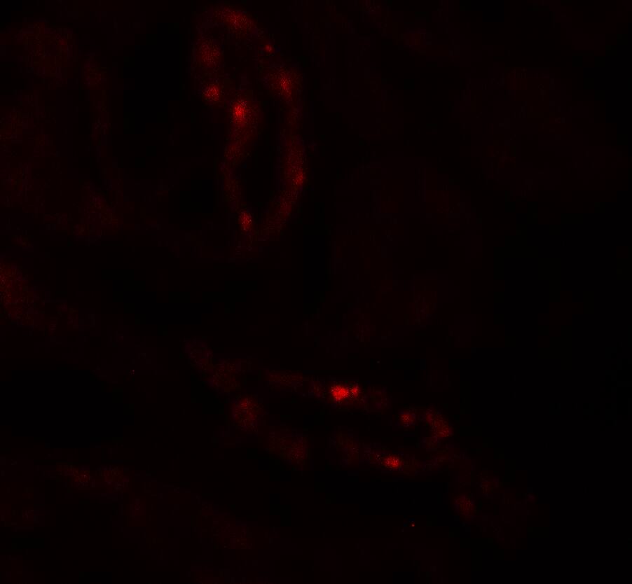 Immunocytochemistry/ Immunofluorescence: SCUBE3 Antibody - BSA Free [NBP2-41186] - Immunofluorescence of SCUBE3 in human kidney tissue with SCUBE3 antibody at 20 ug/mL.