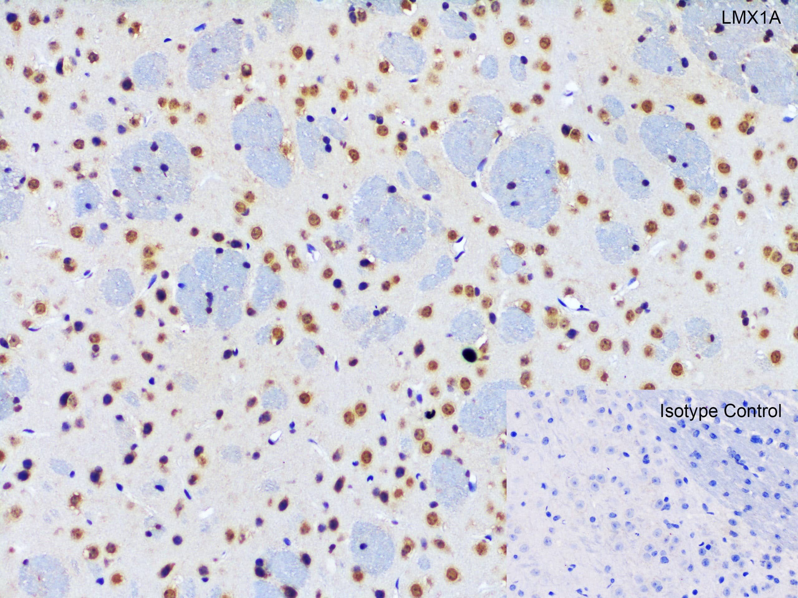 Immunohistochemistry LMX1A Antibody - BSA Free