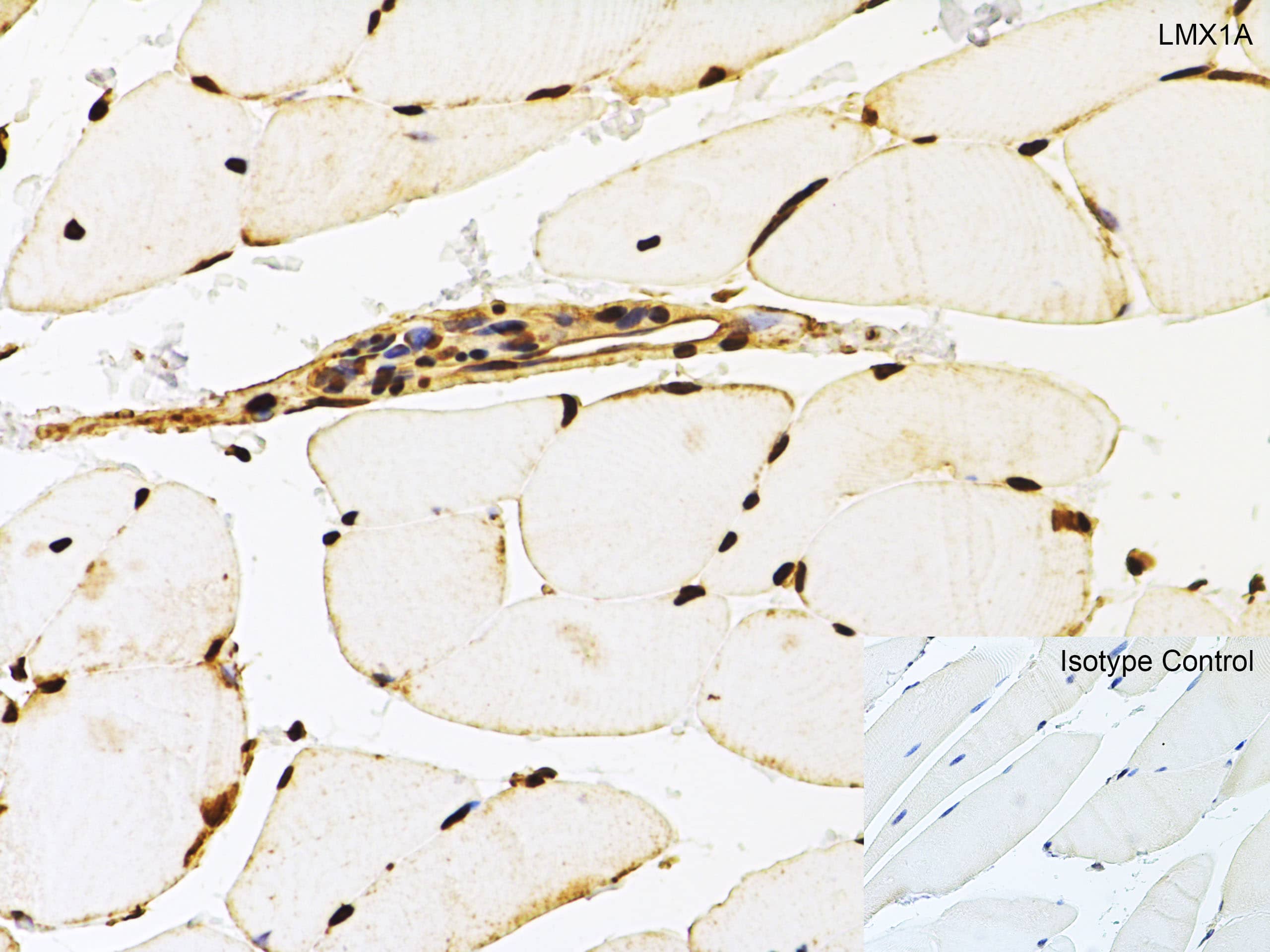 Immunohistochemistry: LMX1A Antibody - BSA Free [NBP2-41193] - Figure 7 Immunohistochemistry Validation of LMX1A in Rat Skeletal Muscle Tissue Immunohistochemical analysis of paraffin-embedded rat spleen tissue using anti-LMX1A antibody  at 5 u/ml. Tissue was fixed with formaldehyde and blocked with 10% serum for 1 h at RT; antigen retrieval was by heat mediation with a citrate buffer (pH6). Samples were incubated with primary antibody overnight at 4C. A goat anti-rabbit IgG H&L (HRP) at 1/250 was used as secondary. Counter stained with Hematoxylin.