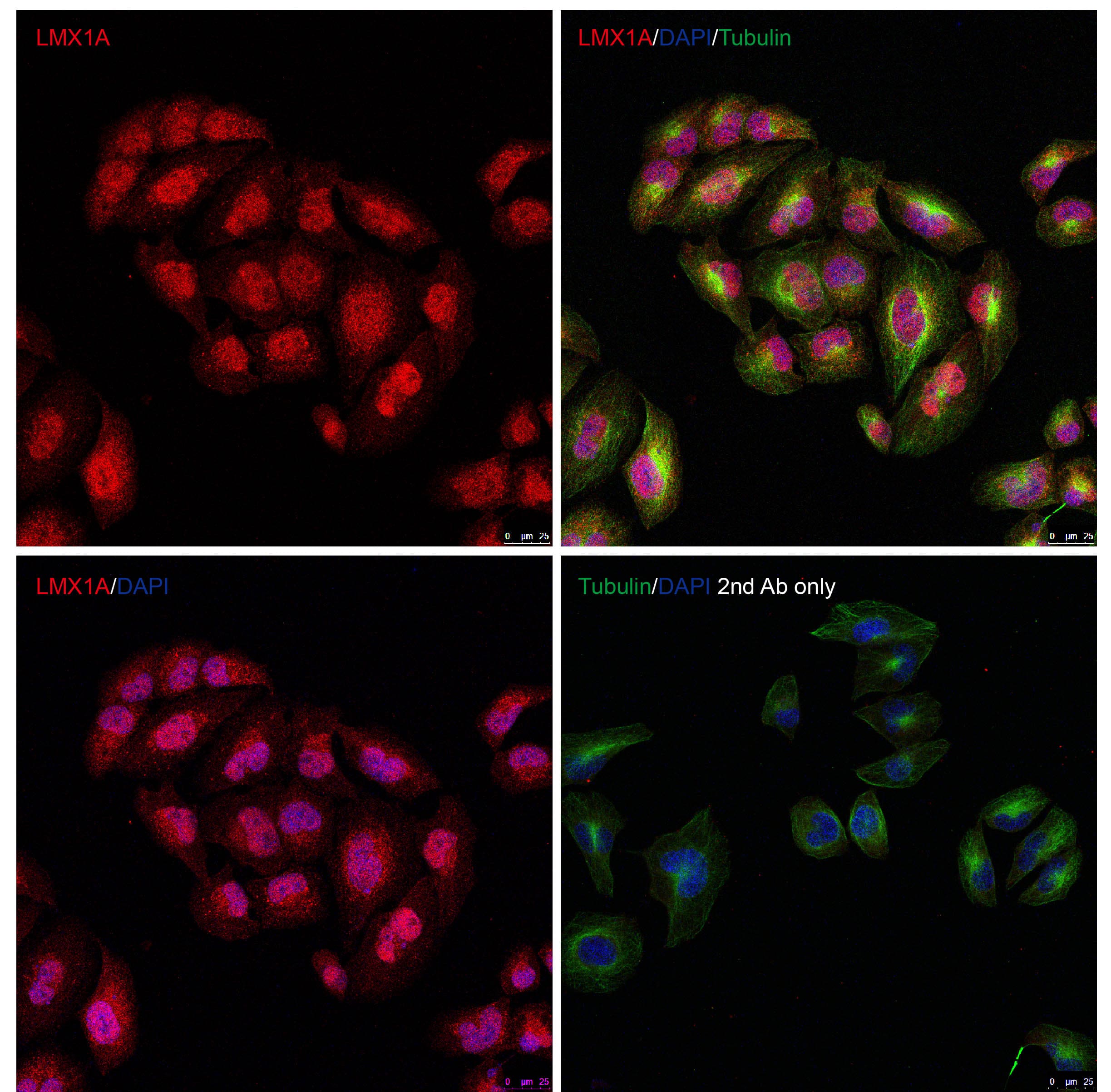 Immunocytochemistry/ Immunofluorescence: LMX1A Antibody - BSA Free [NBP2-41193] - Figure 1 Immunofluorescence Validation of LMX1A in HeLa CellsImmunofluorescent analysis of methanol-fixed HeLa cells labeling LMX1A with  at 10 u/mL, followed by goat anti-rabbit IgG secondary antibody at 1/1000 dilution (red) and DAPI staining (blue). Alpha tubulin was stained with anti-alpha tubulin antibody following by goat anti-mouse IgG secondary antibody (green). Images were captured with confocal microscopy. 