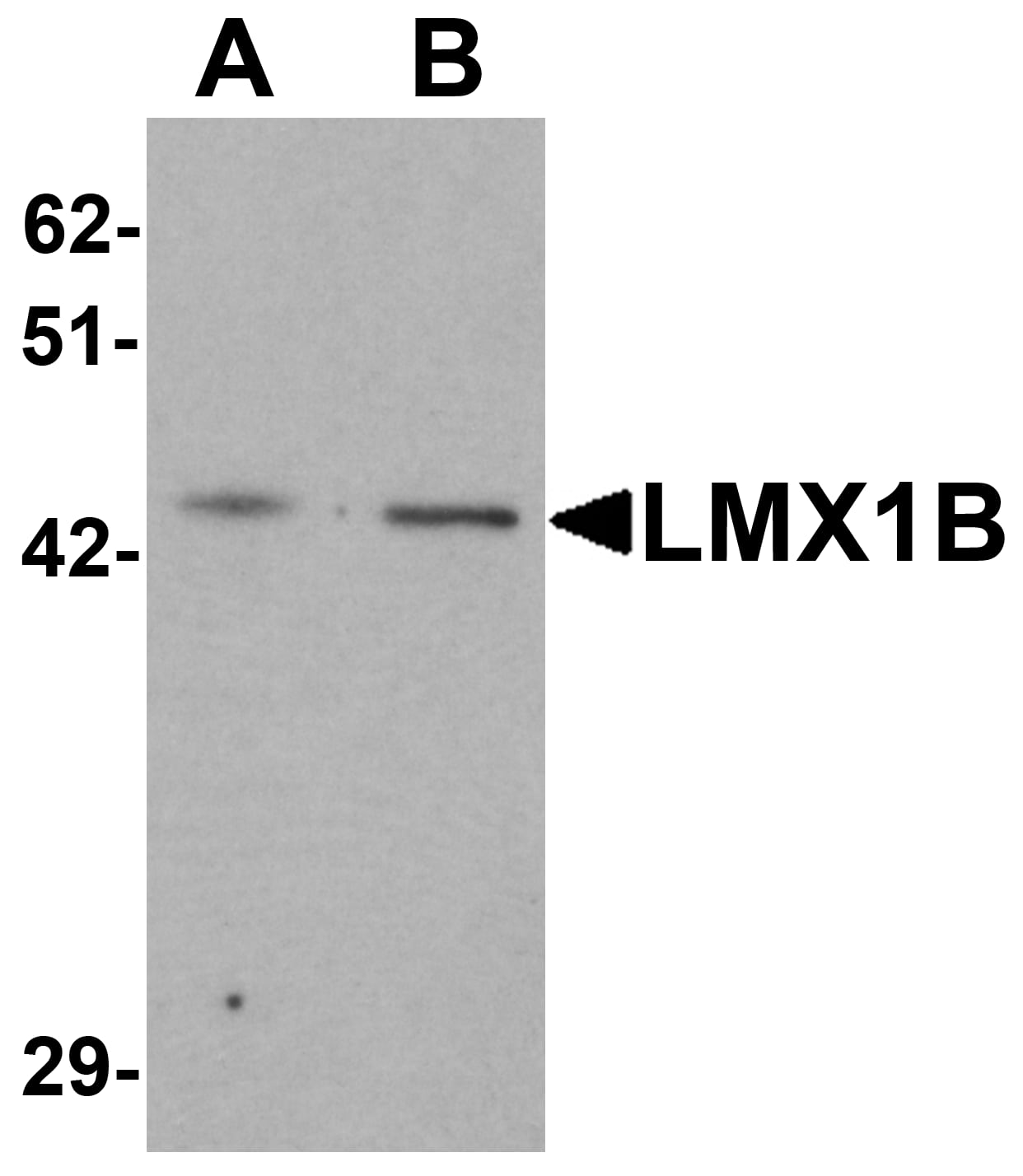 Western Blot: LMX1b Antibody - BSA Free [NBP2-41194] - Western blot analysis of LMX1b in A-20 cell lysate with LMX1b antibody at (A) 1 and (B) 2 u/mL.