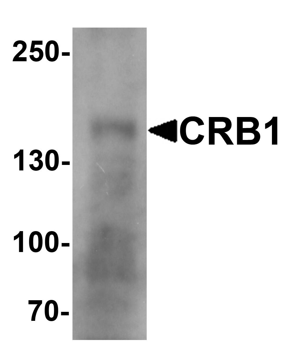 Western Blot: CRB1 Antibody - BSA Free [NBP2-41201] - Western blot analysis of CRB1 in human small intestine Tissue lysate with CRB1 antibody at 1 u/mL.