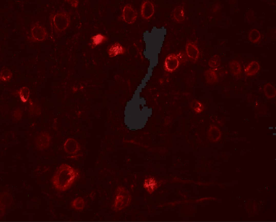 Immunocytochemistry/ Immunofluorescence: TPT1/TCTP Antibody - BSA Free [NBP2-41206] - Immunofluorescence of TPT1/TCTP in rat brain tissue with TPT1/TCTP antibody at 20 ug/ml.