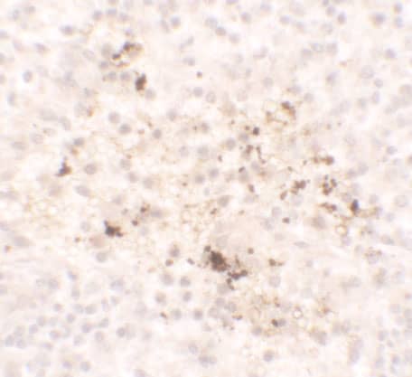 Immunohistochemistry: CCL2/MCP1 Antibody - BSA Free [NBP2-41209] - Immunohistochemistry of CCL2/MCP1 in human spleen tissue with CCL2/MCP1 antibody at 5 ug/ml.