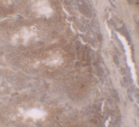 Immunohistochemistry: GilZ Antibody - BSA Free [NBP2-41210] - Immunohistochemistry of GilZ in human small intestine tissue with GilZ antibody at 5 ug/ml.