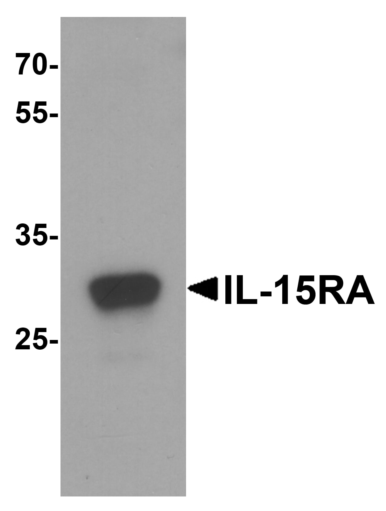Western Blot: IL-15R alpha Antibody - BSA Free [NBP2-41212] - Western blot analysis of IL-15R alpha in rat small intestine tissue lysate with IL-15R alpha antibody at 1 ug/mL.