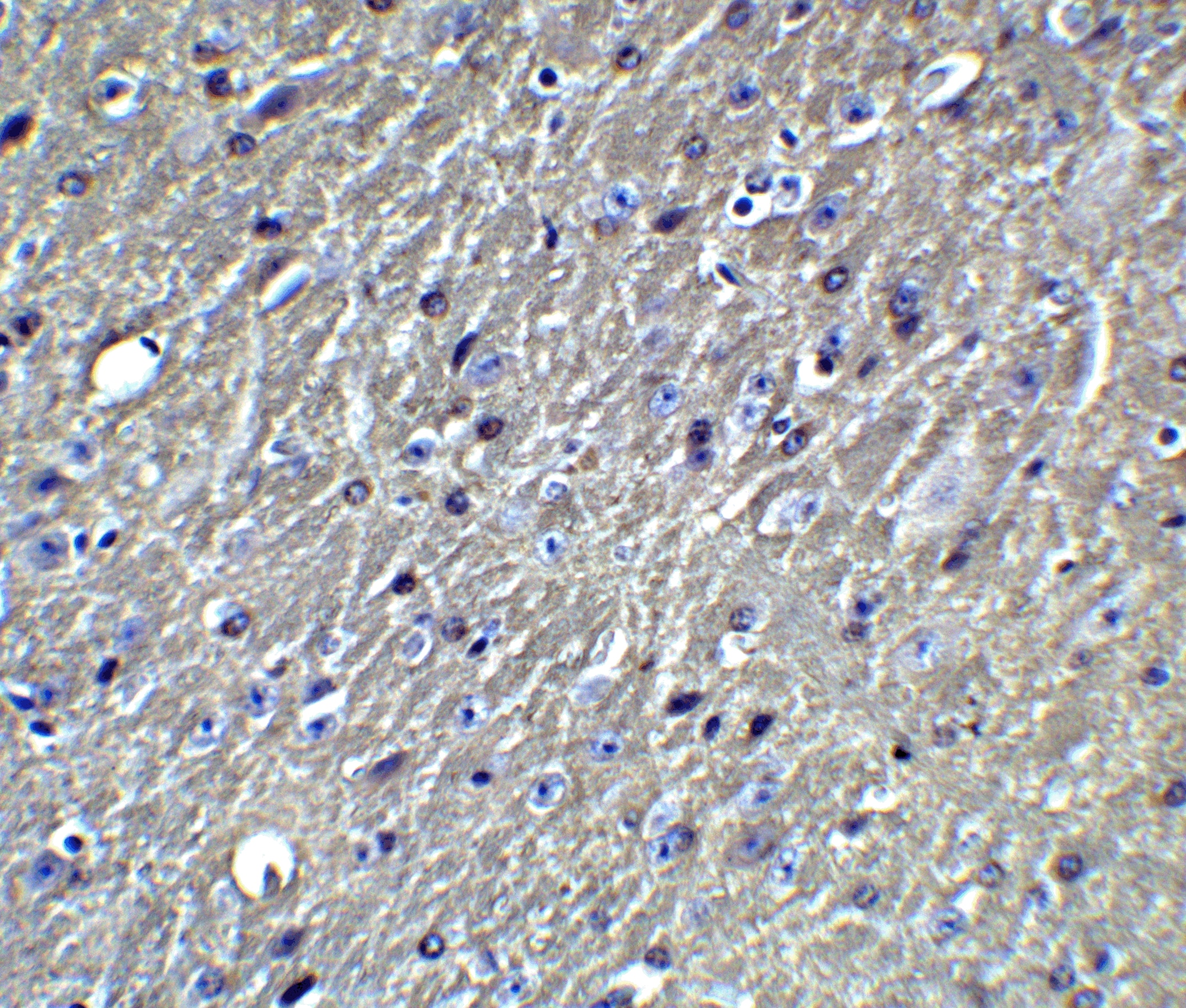 Immunohistochemistry: Apolipoprotein E/ApoE Antibody - BSA Free [NBP2-41216] - Immunohistochemistry of APO E in mouse brain tissue with APO E Antibody at 5 ug/mL.