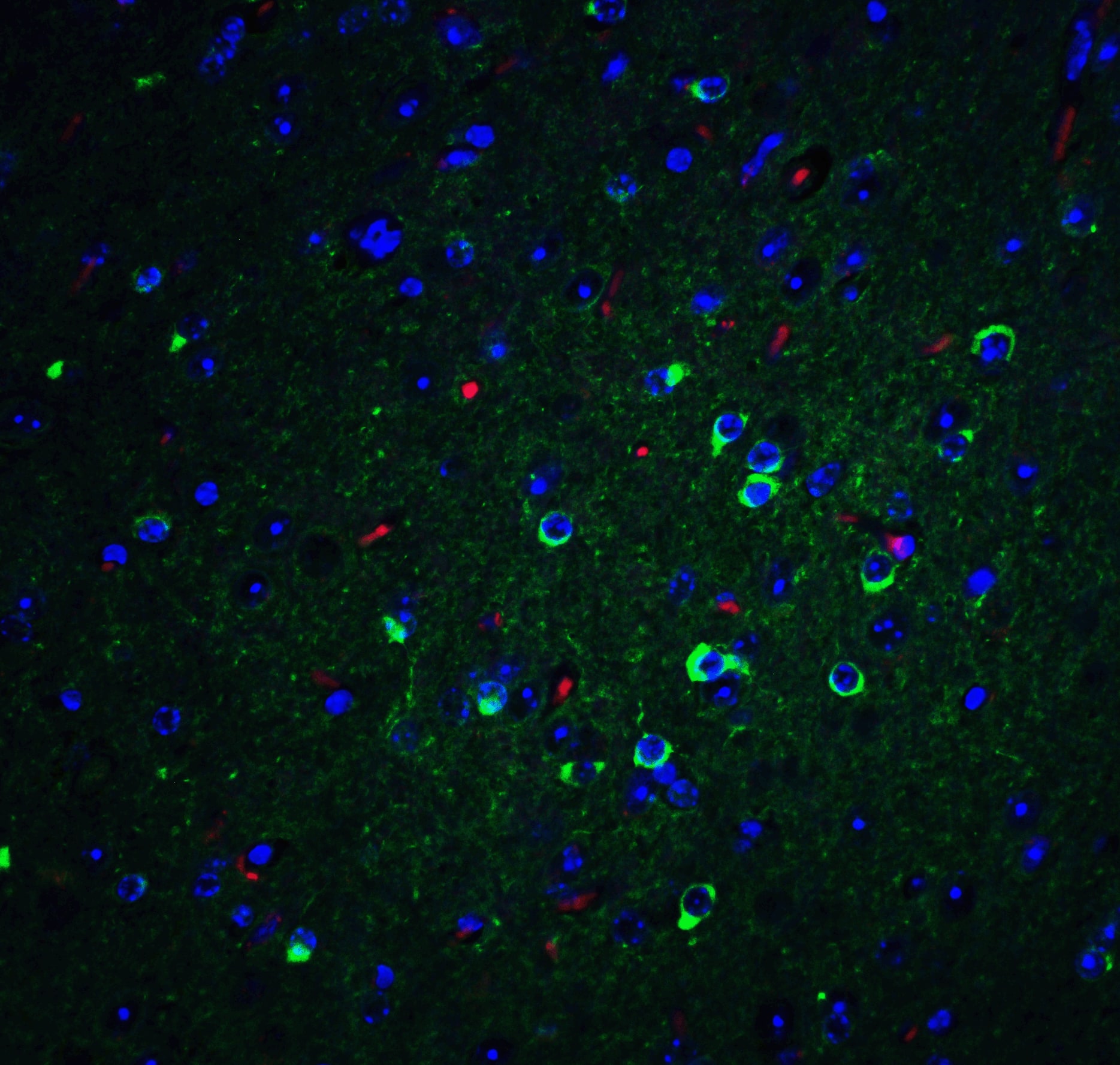 Immunocytochemistry/ Immunofluorescence: Apolipoprotein E/ApoE Antibody - BSA Free [NBP2-41216] - Immunofluorescence of APO E in mouse brain tissue with APO E Antibody at 20 ug/mL. Green: APO E antibody   Red: Phylloidin staining Blue: DAPI staining