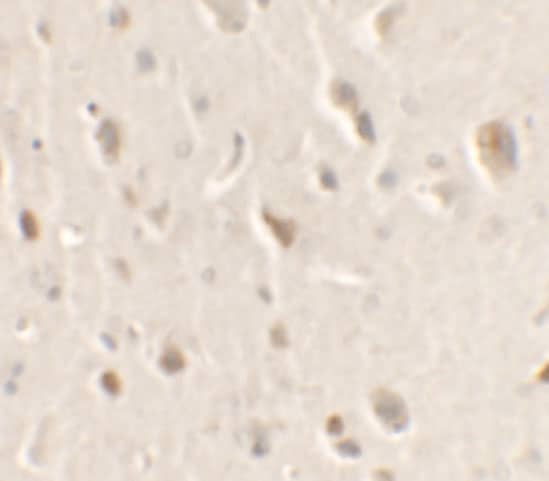 Immunohistochemistry ULK1 Antibody - BSA Free