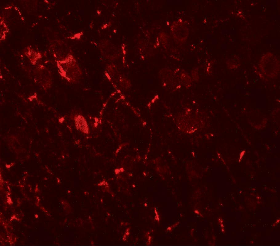 Immunocytochemistry/ Immunofluorescence ULK1 Antibody - BSA Free