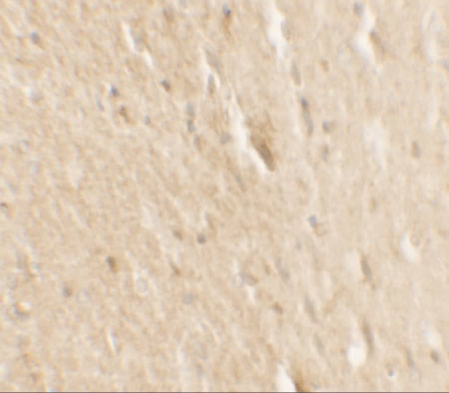 Immunohistochemistry: B-Raf Antibody - BSA Free [NBP2-41219] -  Validation of B-Raf in Human Small Intestine Tissue.   Immunohistochemical analysis of paraffin-embedded Human Small Intestine Tissue using anti-B-Raf antibody  at 2.5 ug/ml. Tissue was fixed with formaldehyde and blocked with 10% serum for 1 h at RT; antigen retrieval was by heat mediation with a citrate buffer (pH6). Samples were incubated with primary antibody overnight at 4C. A goat anti-rabbit IgG H&L (HRP) at 1/250 was used as secondary. Counter stained with Hematoxylin.