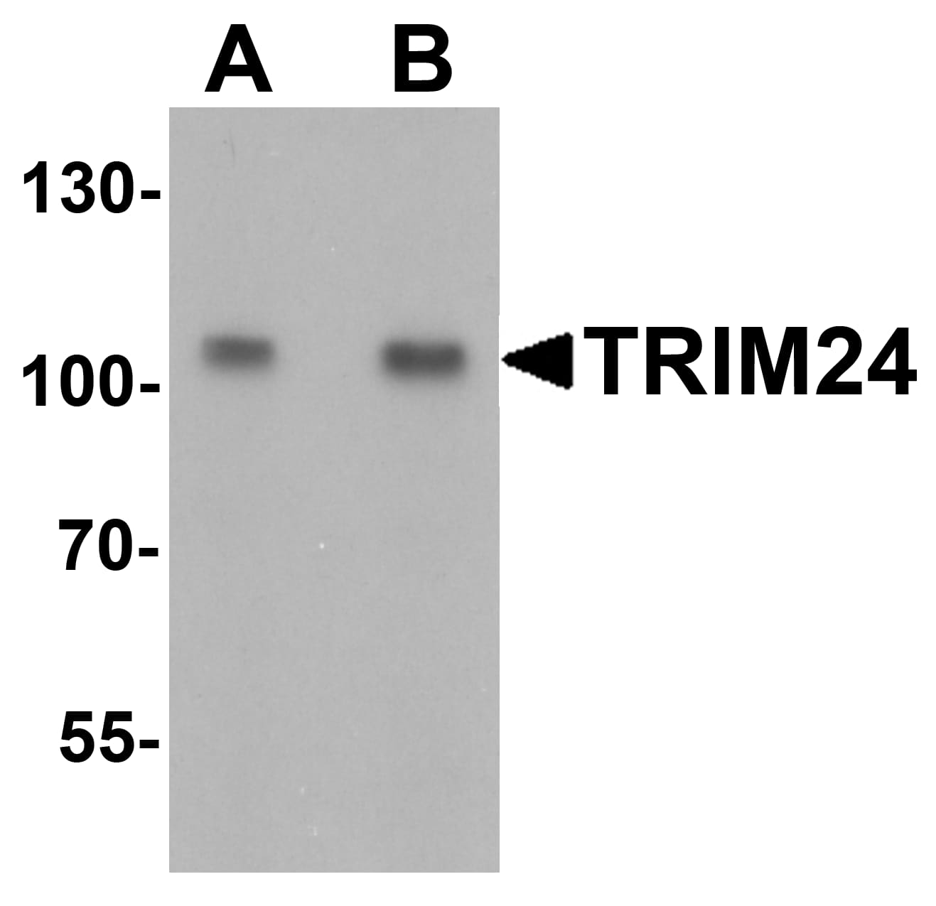 Western Blot: TIF1 alpha Antibody - BSA Free [NBP2-41220] - Western blot analysis of TIF1 alpha in A431 cell lysate with TIF1 alpha antibody at (A) 0.5 and (B) 1 u/mL.