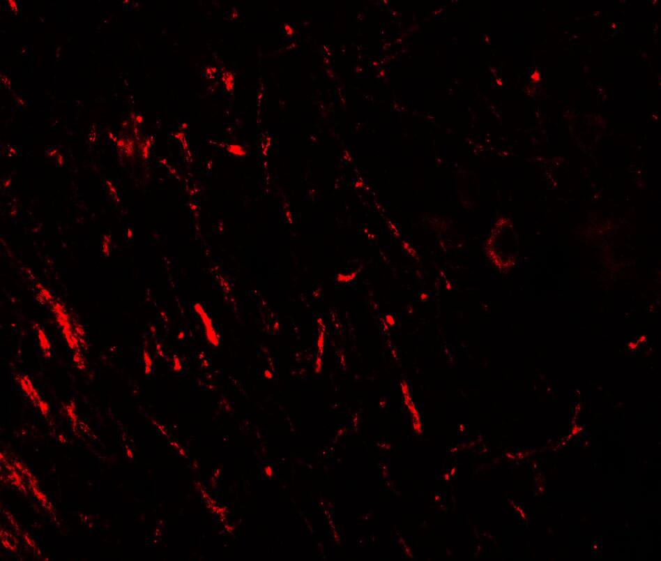 Immunocytochemistry/ Immunofluorescence: PRAS40 Antibody - BSA Free [NBP2-41221] - Immunofluorescence of PRAS40 in rat brain tissue with PRAS40 antibody at 20 u/ml.