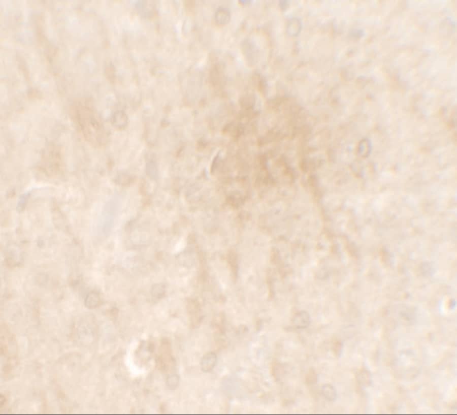 Immunohistochemistry: FGFR3 Antibody - BSA Free [NBP2-41227] - Immunohistochemistry of FGFR3 in rat brain tissue with FGFR3 antibody at 2.5 u/mL.