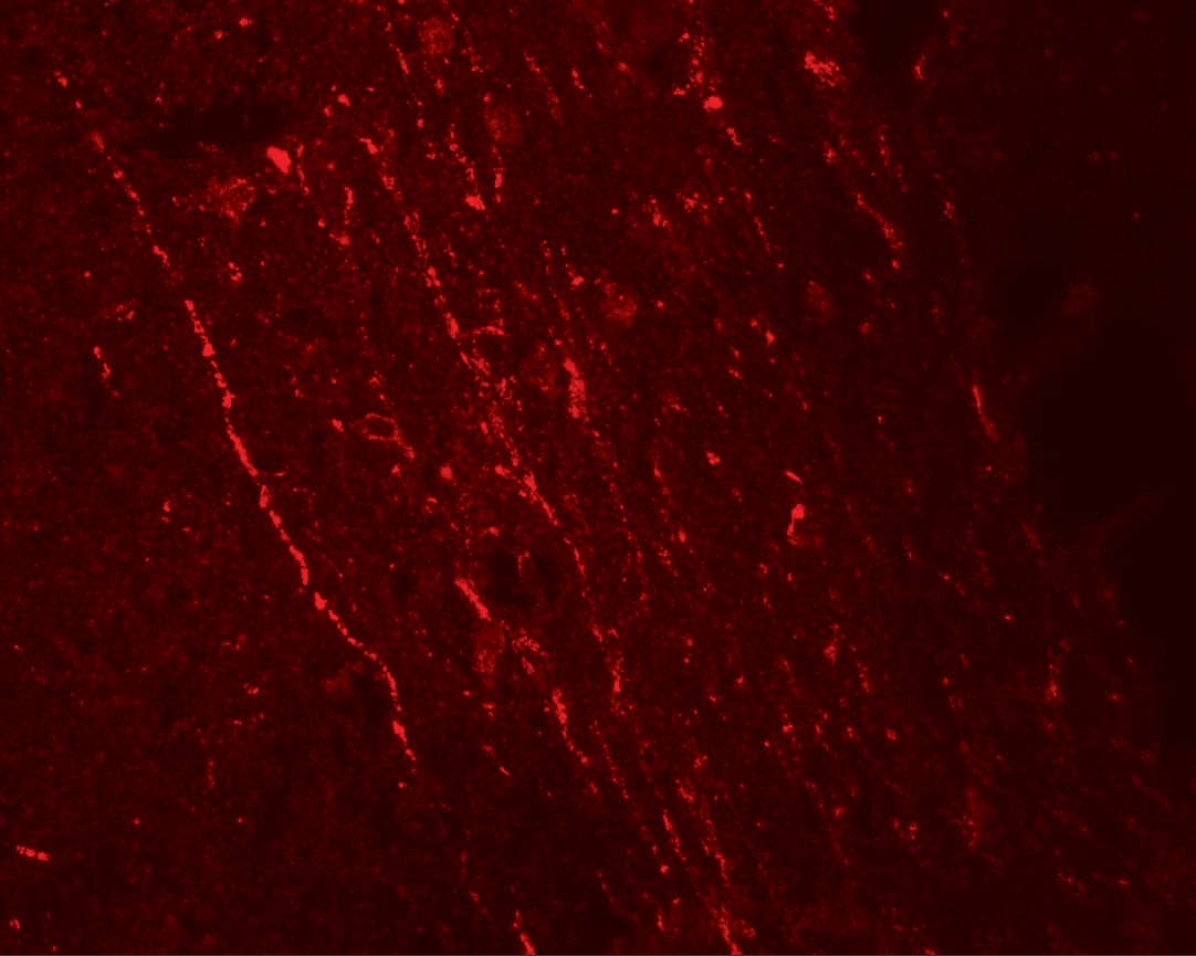 Immunocytochemistry/ Immunofluorescence: FGFR3 Antibody - BSA Free [NBP2-41227] - Immunofluorescence of FGFR3 in rat brain tissue with FGFR3 antibody at 20 u/mL.