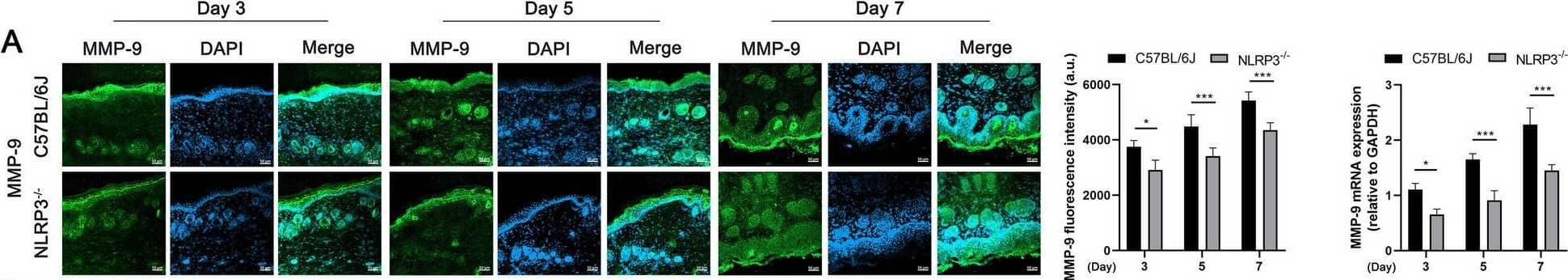 NLRP3 is involved in tissue growth related factors expression in wound site (A-D) Skin wound tissues from wild-type and NLRP3−/− mice were subjected to immunofluorescence staining for MMP-9 (green), ER alpha  (red), EGF (green), VEGF (red), and nuclei (DAPI, blue) on days 3, 5, and 7 post-injury. The merged images represent the composite pictures of the target protein and nuclei. Immunofluorescence staining was visualized using fluorescence microscopy (Zeiss LSM 800 laser, ×200 magnification), and the mean fluorescence intensity was quantified (a.u., arbitrary units). The mRNA expression of MMP-9, ER alpha , EGF, and VEGF in wild-type and NLRP3−/− skin wound tissues was quantified using RT-PCR. GAPDH serves as internal reference. Results are expressed as mean +/- SD from multiple independent experiments and were analyzed using Student t test (n = 5). Statistical significance is indicated as follows: *P < 0.05, **P < 0.01, ***P < 0.001. Scale bar = 20 μm Image collected and cropped by CiteAb from the following open publication (//pubmed.ncbi.nlm.nih.gov/39881348), licensed under a CC-BY license. Not internally tested by Novus Biologicals.