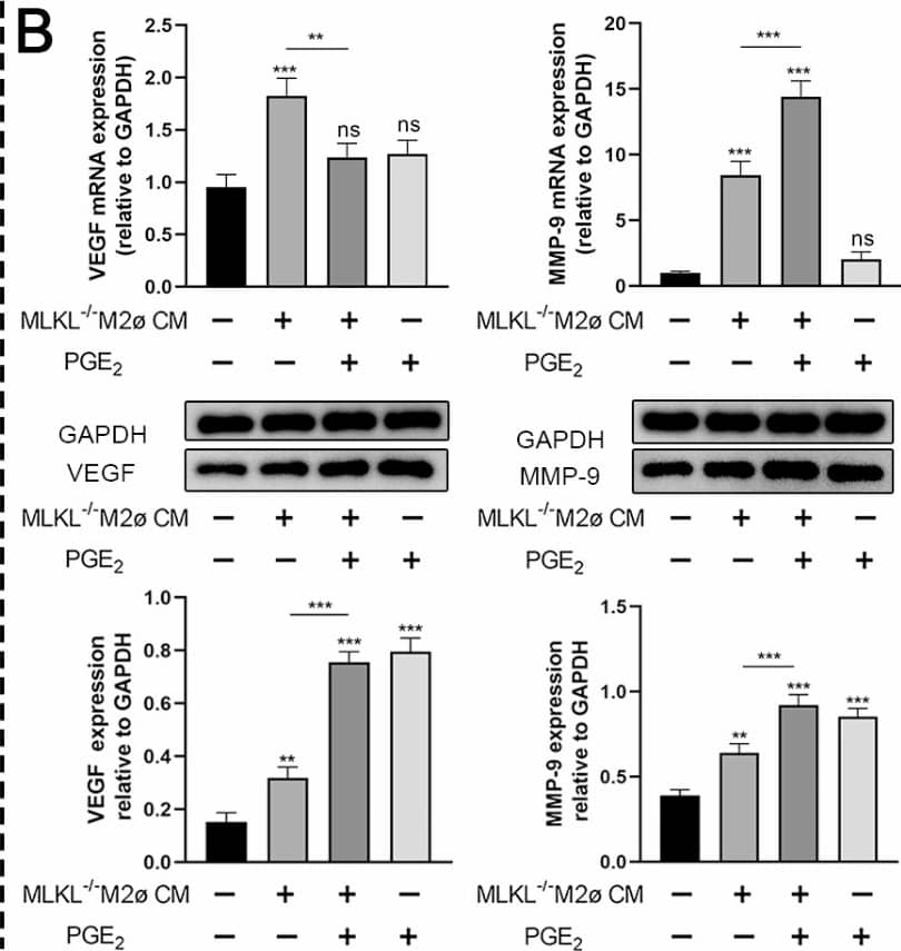 MLKL in macrophages affects myofibroblasts activities through PGE2. (A) The mRNA and protein expression of VEGF, MMP-9 in MLKL+/+ myofibroblasts treated with MLKL−/− M1ø CM or with PGE2 supplement. (B) The mRNA and protein expression of VEGF, MMP-9 in MLKL+/+ myofibroblasts treated with MLKL−/− M2ø CM or with PGE2 supplement. GAPDH was used as a loading control. Grayscale values were measured using ImageJ software. Littermate control mice were on a C57BL/6J genetic background were utilized in the experiments. Results were expressed as the mean +/- SD and were analyzed by one-way ANOVA followed by Tukey’s multiple comparisons test (n = 4–6). *P < 0.05, **P < 0.01, ***P < 0.001. ns not significant. Image collected and cropped by CiteAb from the following open publication (//pubmed.ncbi.nlm.nih.gov/40253554), licensed under a CC-BY license. Not internally tested by Novus Biologicals.