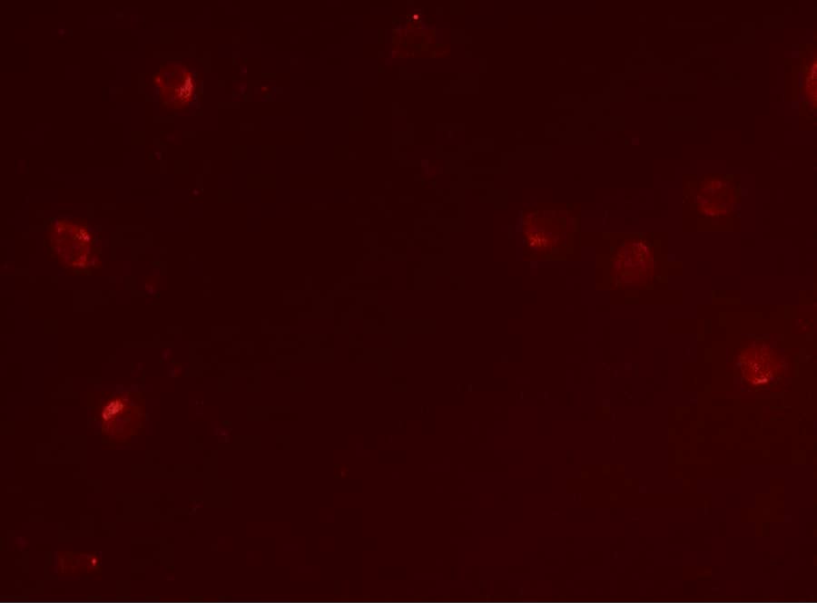 Immunocytochemistry/ Immunofluorescence: CD160 Antibody - BSA Free [NBP2-41234] - Immunofluorescence of CD160 in Jurkat cells tissue with CD160 antibody at 5 ug/mL.