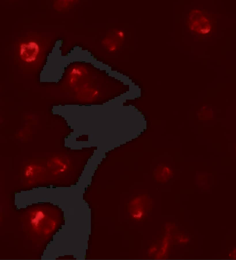 Immunocytochemistry/ Immunofluorescence: T-bet/TBX21 Antibody - BSA Free [NBP2-41235] - Immunofluorescence of T-bet/TBX21 in 293 cells with T-bet/TBX21 antibody at 5 ug/mL.