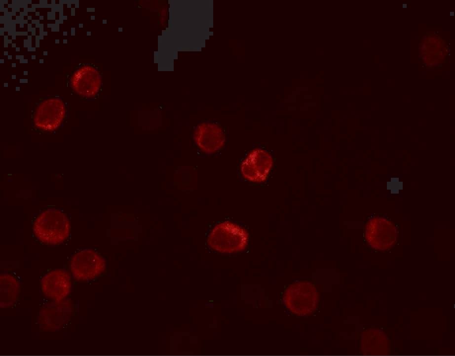 Immunocytochemistry/ Immunofluorescence: IL-28B/IFN-lambda 3 Antibody - BSA Free [NBP2-41236] - Immunofluorescence of IL-28B/IFN-lambda 3 in HeLa cells with IL-28B/IFN-lambda 3 antibody at 5 ug/mL.