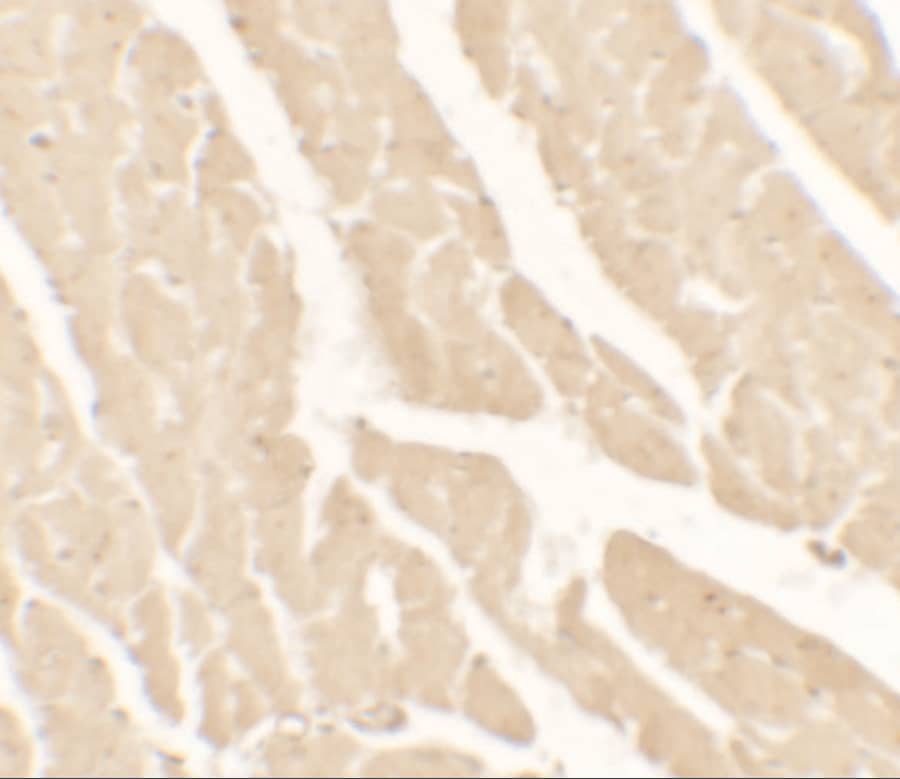 Immunohistochemistry: Vinculin Antibody - BSA Free [NBP2-41237] - Validation of Vinculin in Rat Small Intestine Tissue. Immunohistochemical analysis of paraffin-embedded rat small intestine tissue using anti-Vinculin antibody  at 5 ug/ml. Tissue was fixed with formaldehyde and blocked with 10% serum for 1 h at RT; antigen retrieval was by heat mediation with a citrate buffer (pH6). Samples were incubated with primary antibody overnight at 4C. A goat anti-rabbit IgG H&L (HRP) at 1/250 was used as secondary. Counter stained with Hematoxylin.