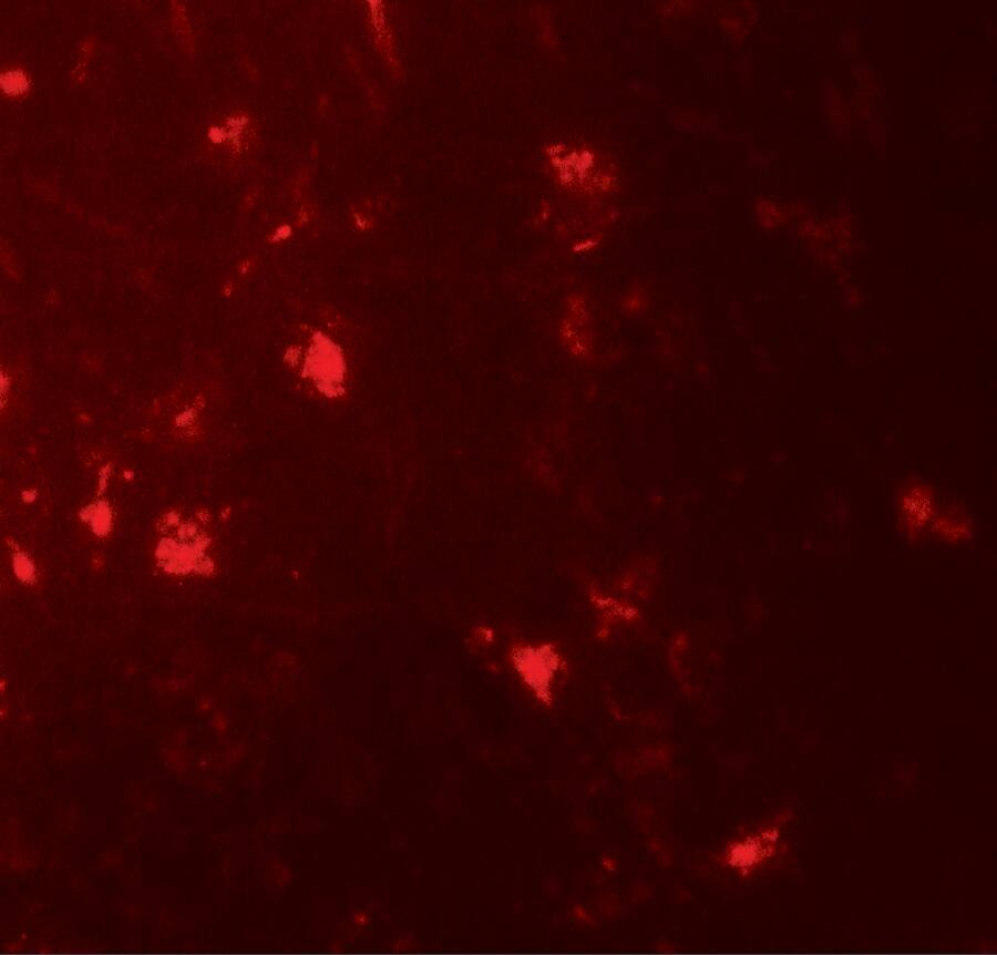 Immunocytochemistry/ Immunofluorescence: IL-36 alpha/IL-1F6 Antibody - BSA Free [NBP2-41238] - Immunofluorescence of IL-36 alpha/IL-1F6 in human brain tissue with IL-36 alpha/IL-1F6 antibody at 20 ug/mL.