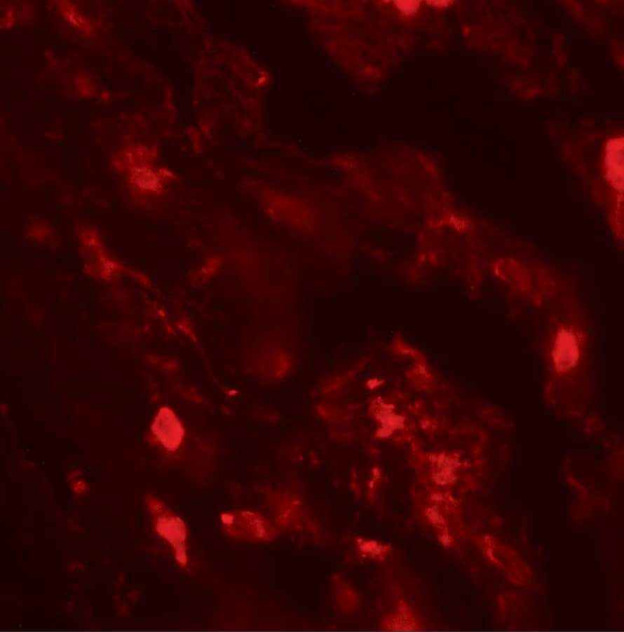 Immunocytochemistry/ Immunofluorescence: IL-36 beta/IL-1F8 Antibody - BSA Free [NBP2-41239] - Immunofluorescence of IL-36 beta/IL-1F8 in human lung tissue with IL-36 beta/IL-1F8 antibody at 20 ug/mL.