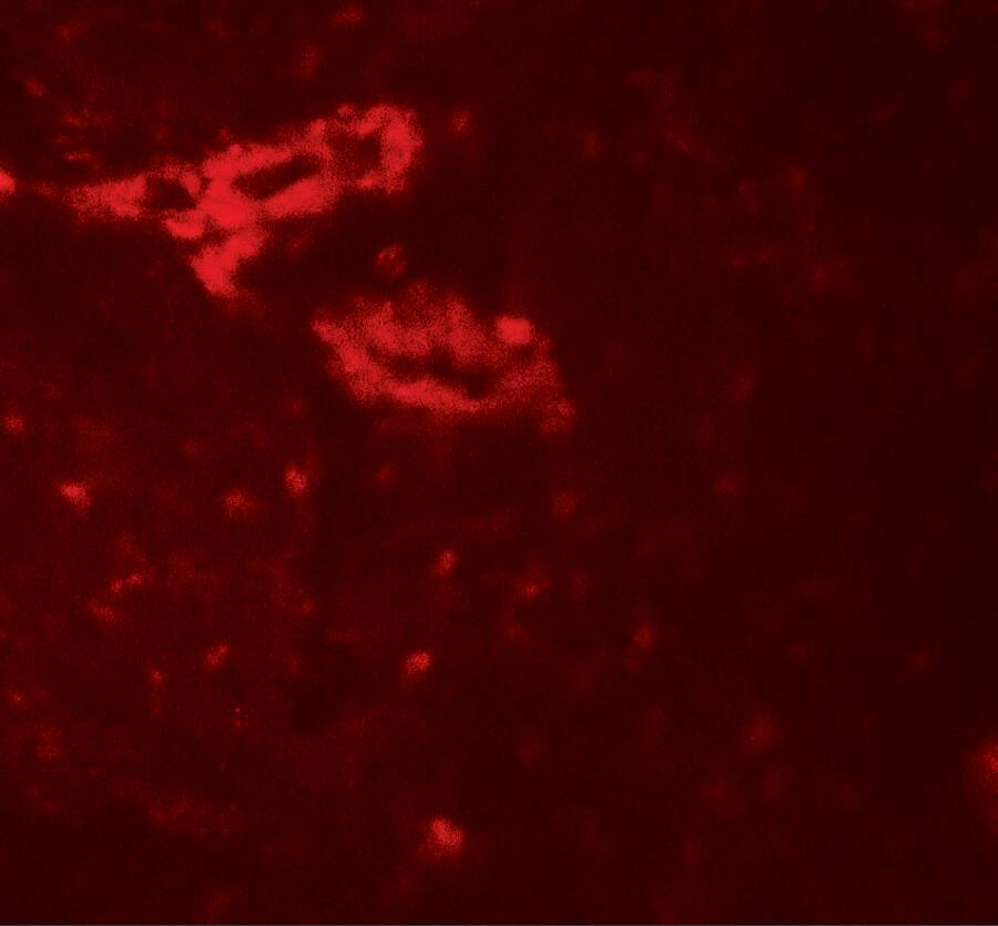 Immunocytochemistry/ Immunofluorescence: IL-36 gamma/IL-1F9 Antibody - BSA Free [NBP2-41240] - Immunofluorescence of IL-36 gamma/IL-1F9 in human bladder tissue with IL-36 gamma/IL-1F9 antibody at 20 ug/mL.