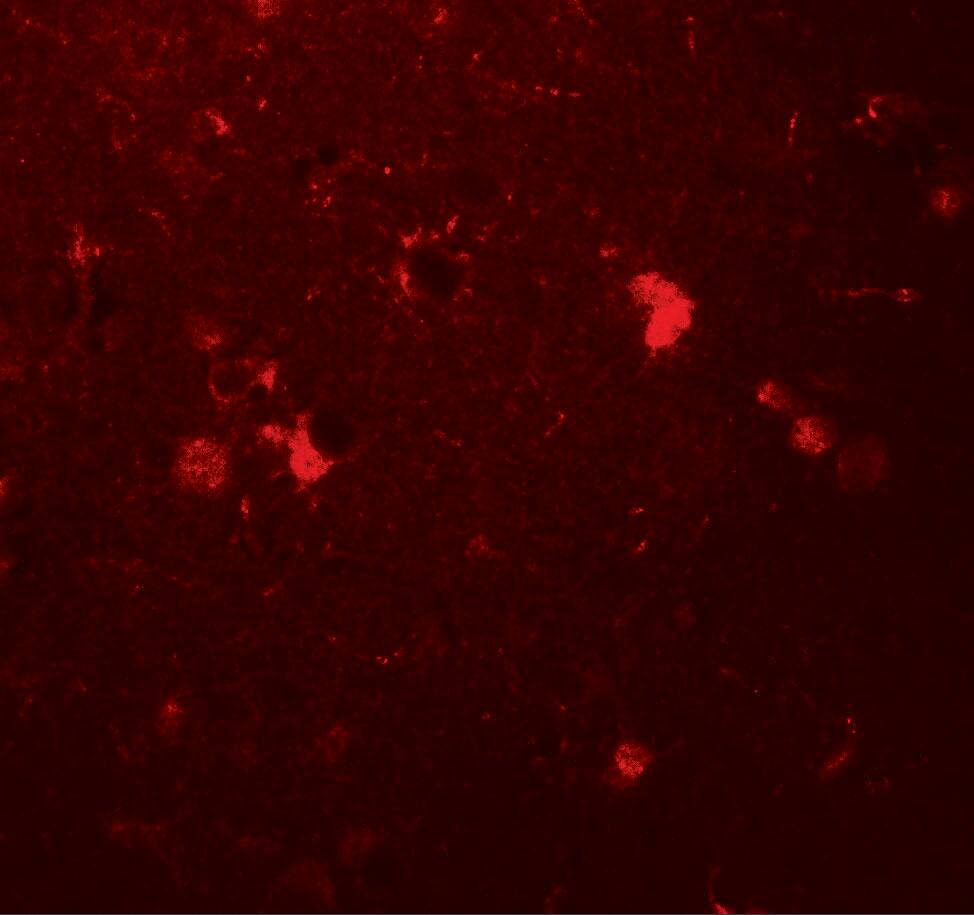 Immunocytochemistry/ Immunofluorescence: ULK3 Antibody - BSA Free [NBP2-41243] - Immunofluorescence of ULK3 in human brain tissue with ULK3 antibody at 20 ug/mL.