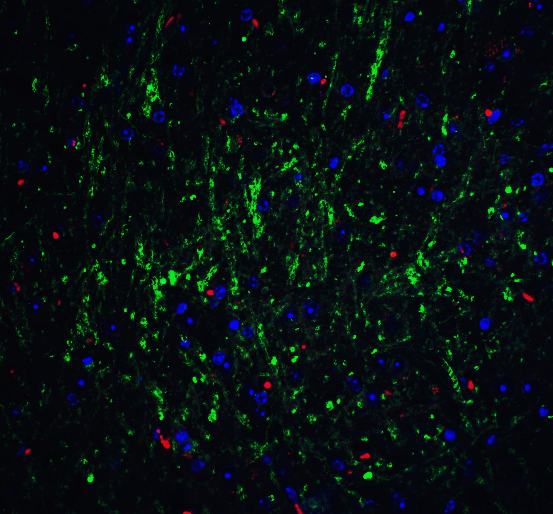 Immunocytochemistry/ Immunofluorescence: RPSA Antibody - BSA Free [NBP2-41246] - Immunofluorescence of RPSA in mouse brain tissue with RPSA Antibody at 20 ug/mL.Green: RPSA antibody   Red: Phylloidin staining Blue: DAPI staining