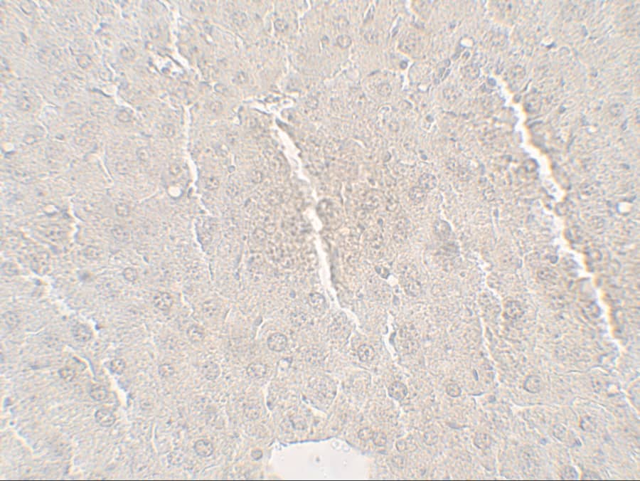 Immunohistochemistry: Angiopoietin-like protein 8/Betatrophin Antibody - BSA Free [NBP2-41247] - Immunohistochemistry of Angiopoietin-like protein 8/Betatrophin in mouse liver tissue with Angiopoietin-like protein 8/Betatrophin antibody at 5 ug/mL.