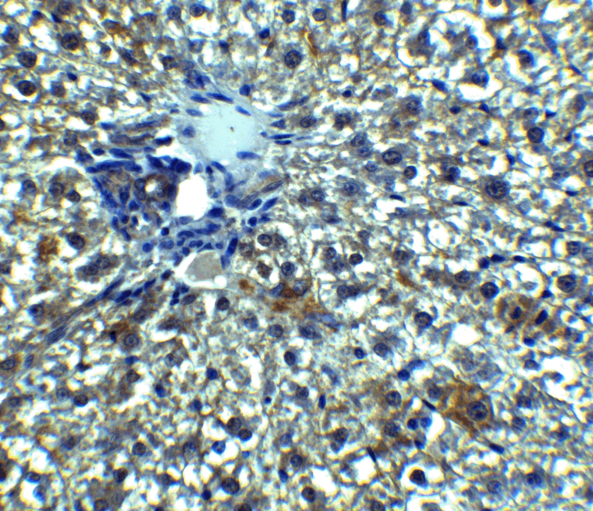 Immunohistochemistry: Angiopoietin-like protein 8/Betatrophin Antibody - BSA Free [NBP2-41247] - Immunohistochemistry of Angiopoietin-like protein 8/Betatrophin in rat liver tissue with Angiopoietin-like protein 8/Betatrophin Antibody at 5 ug/mL.
