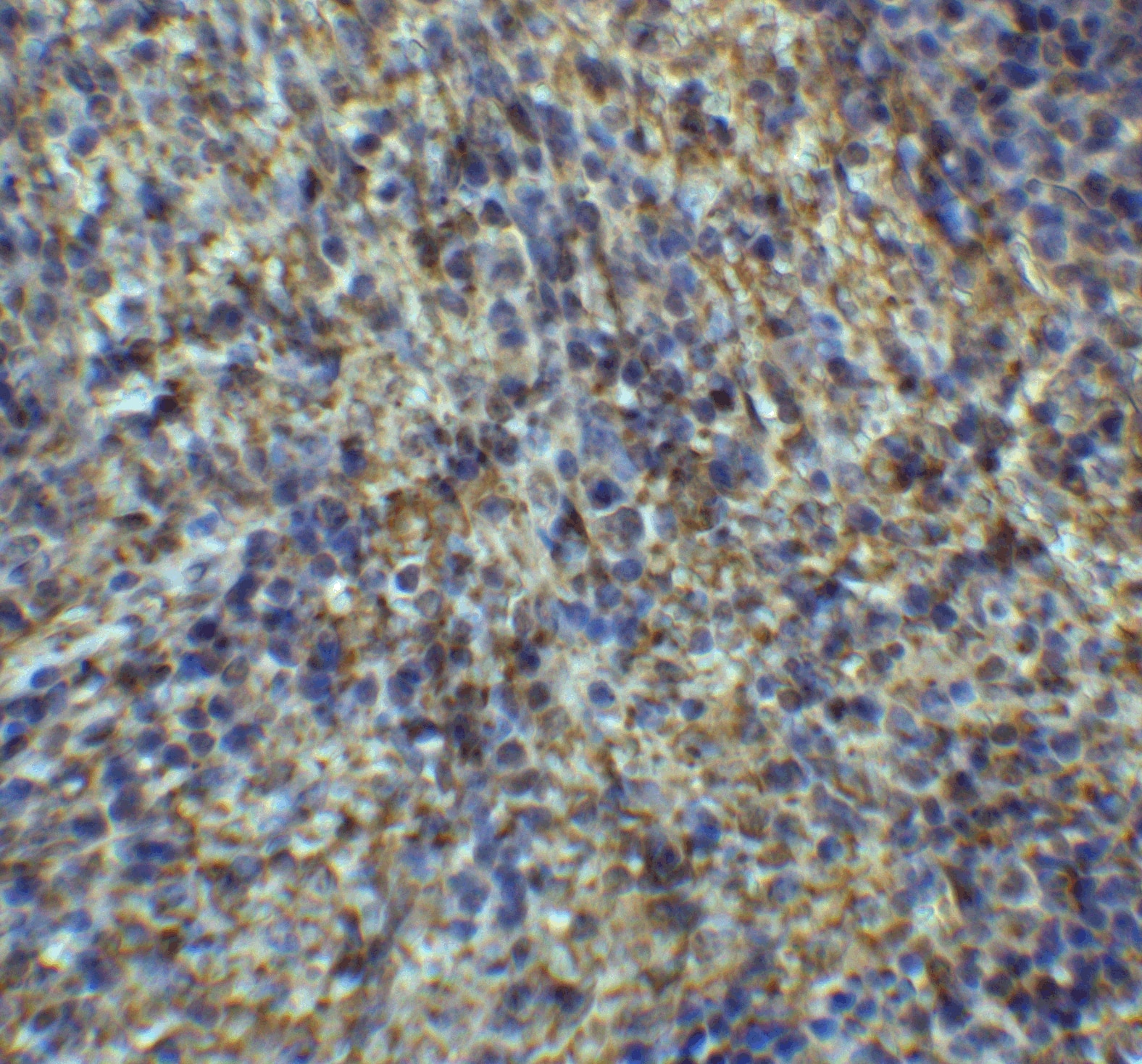 Immunohistochemistry: Arrestin 3 Antibody - BSA Free [NBP2-41249] - Immunohistochemistry of Arrestin 3 in mouse spleen tissue with Arrestin 3 antibody at 2 ug/ml.