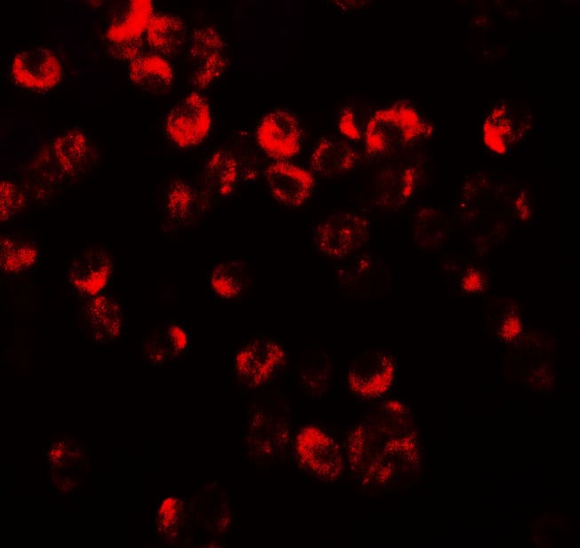 Immunocytochemistry/ Immunofluorescence: CXCR3 Antibody - BSA Free [NBP2-41250] - Immunofluorescence of CXCR3 in HepG2 cells with CXCR3 antibody at 20 ug/mL.