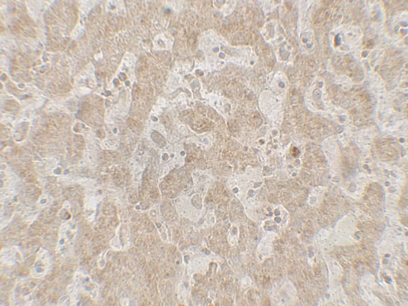 Immunohistochemistry: CCR7 Antibody - BSA Free [NBP2-41251] - Immunohistochemistry of CCR7 in human spleen tissue with CCR7 antibody at 5 ug/mL.