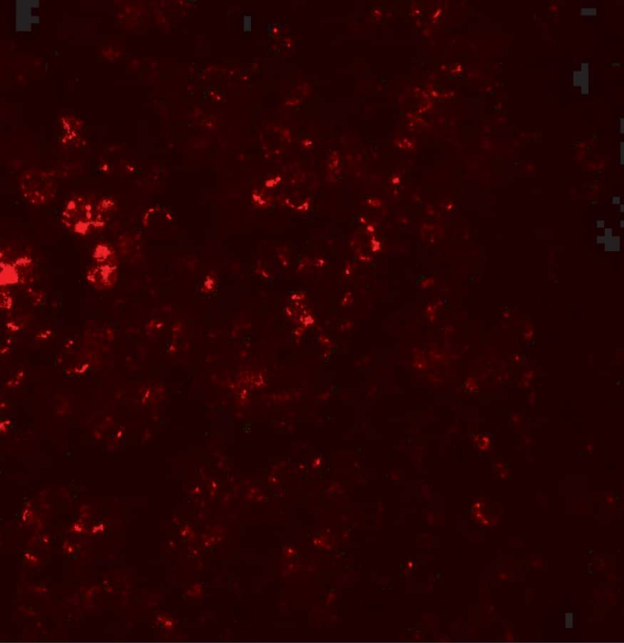 Immunocytochemistry/ Immunofluorescence: CCR7 Antibody - BSA Free [NBP2-41251] - Immunofluorescence of CCR7 in human spleen tissue with CCR7 antibody at 20 ug/mL.