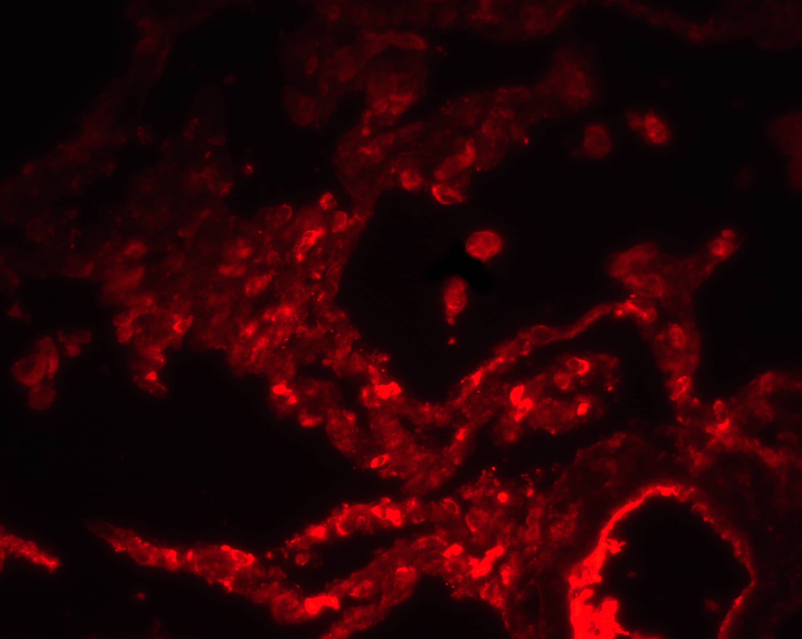 Immunocytochemistry/ Immunofluorescence: SPNS1 Antibody - BSA Free [NBP2-41252] - Immunofluorescence of SPNS1 in human lung tissue with SPNS1 antibody at 20 ug/ml.